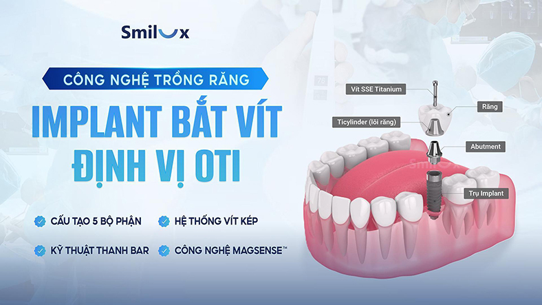 Chuyên gia Smilux cảnh báo nguy hại khôn lường khi trồng răng giá rẻ