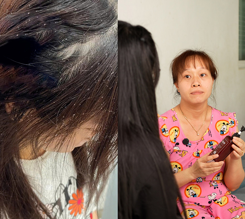 Đỗ Tùng và Hương Nhu Trắng - bộ đôi dược liệu hỗ trợ làm sạch gàu