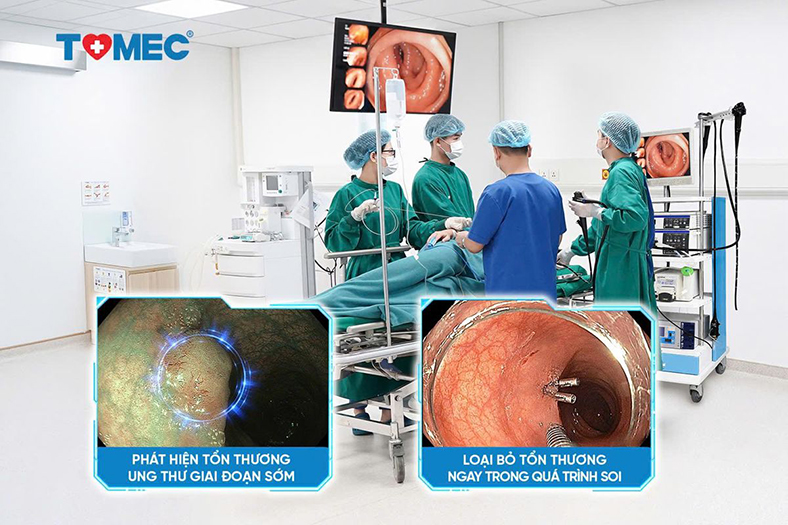 Phòng khám Đa khoa TOMEC: Ứng dụng công nghệ NBI Nhật Bản trong nội soi tiêu hóa