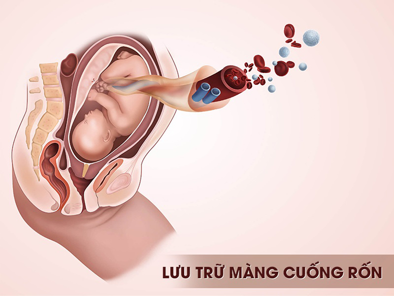 Trải nghiệm nâng ngực tại Bệnh Viện Thẩm Mỹ EMCAS