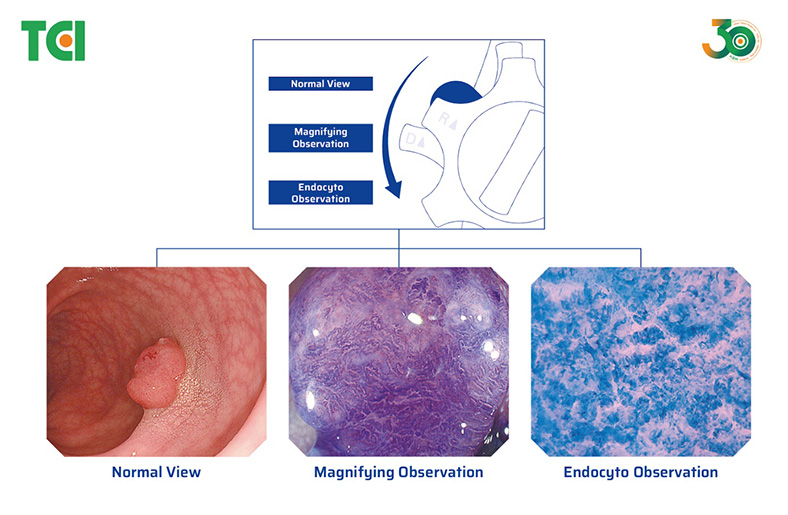 Thu Cúc TCI triển khai công nghệ nội soi siêu phóng đại cấp độ tế bào